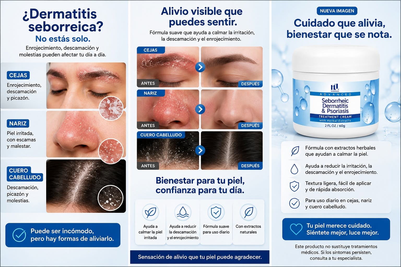 Crema de cuidado intensivo para piel sensible, seca o con descamación